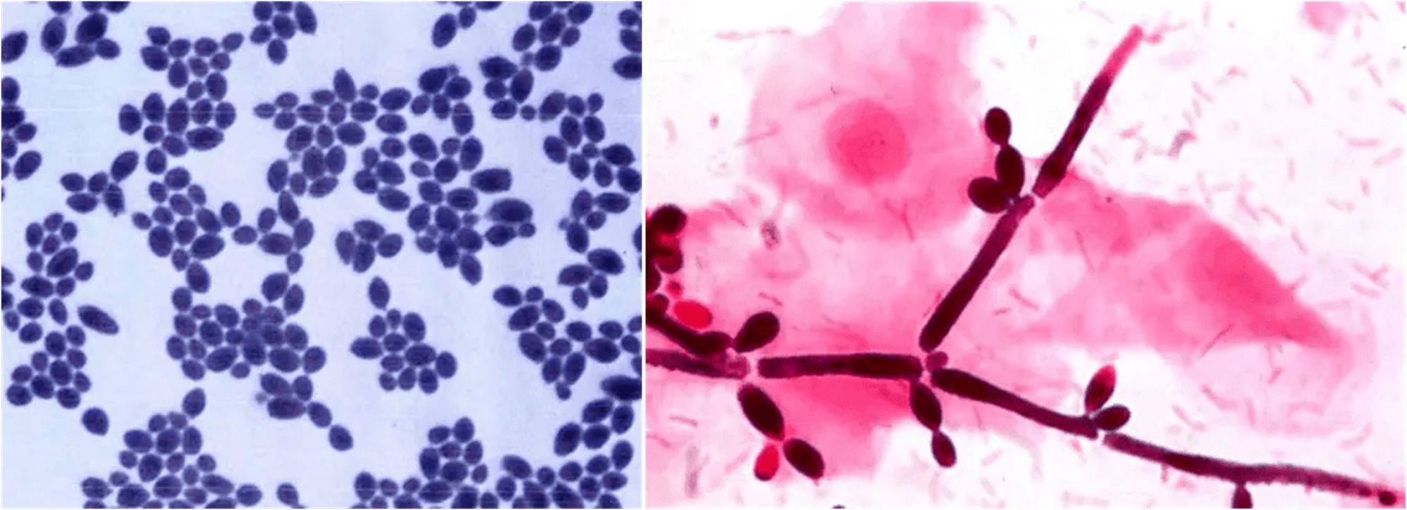 Infezioni sessualmente trasmissibili: diagnosi, terapia e profilassi