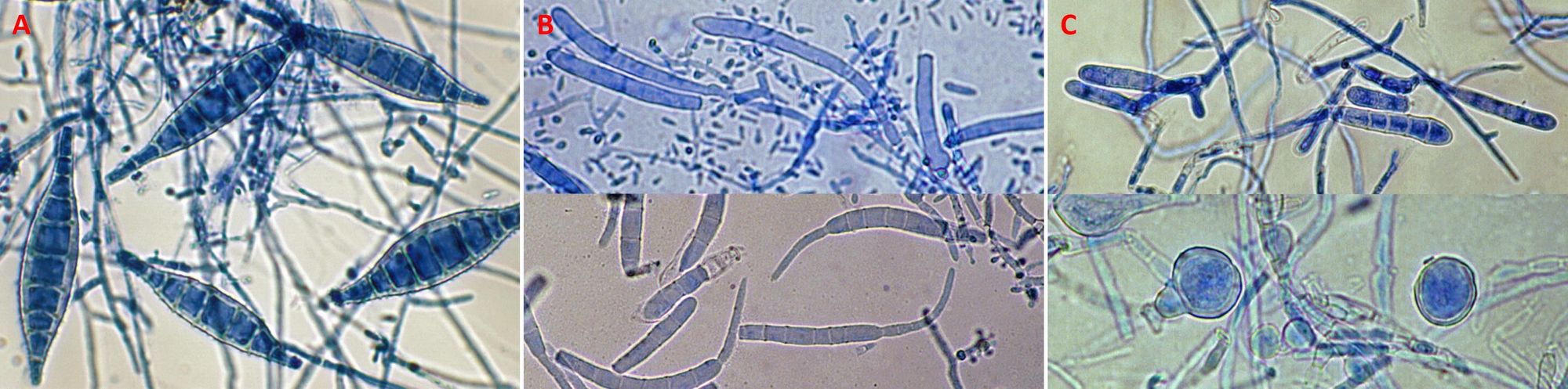 Infezioni sessualmente trasmissibili: diagnosi, terapia e profilassi