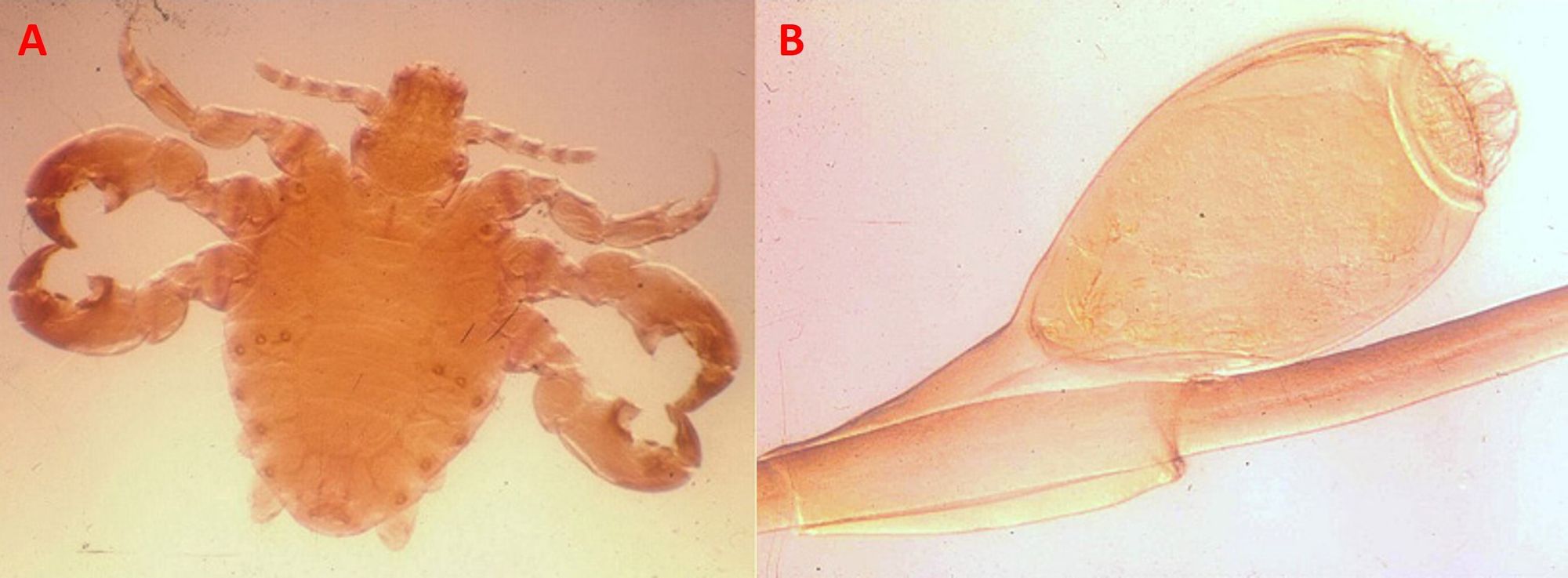 Infezioni sessualmente trasmissibili: diagnosi, terapia e profilassi