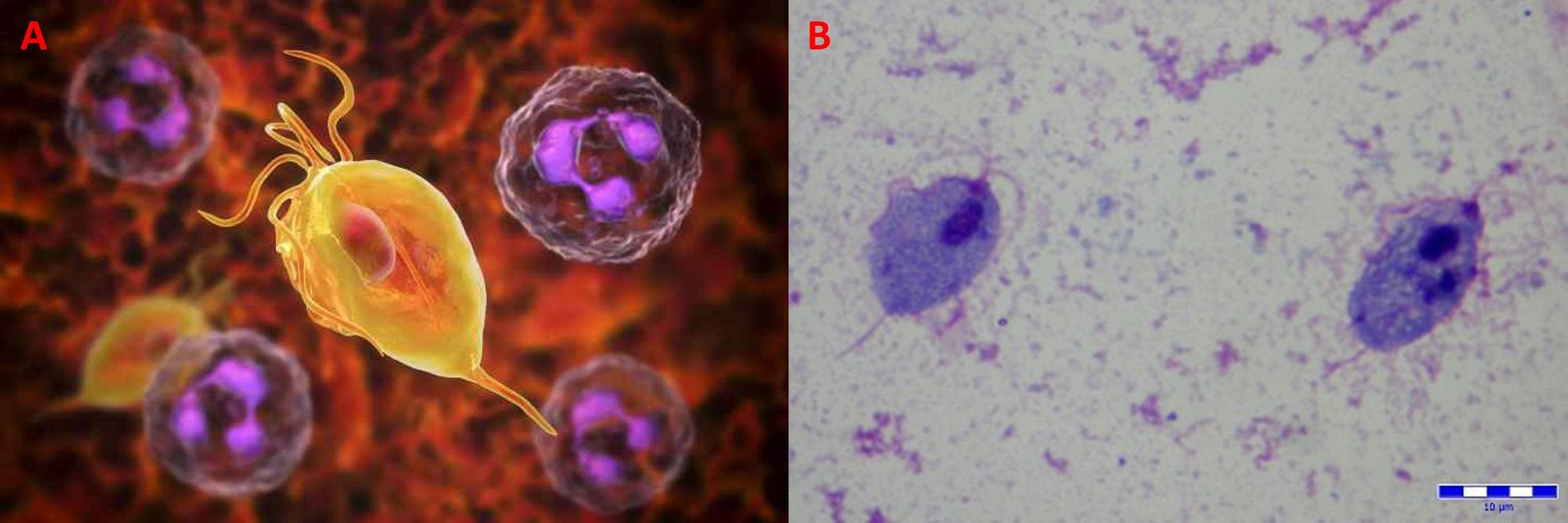 Infezioni sessualmente trasmissibili: diagnosi, terapia e profilassi