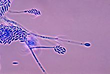 Micotossine negli alimenti
