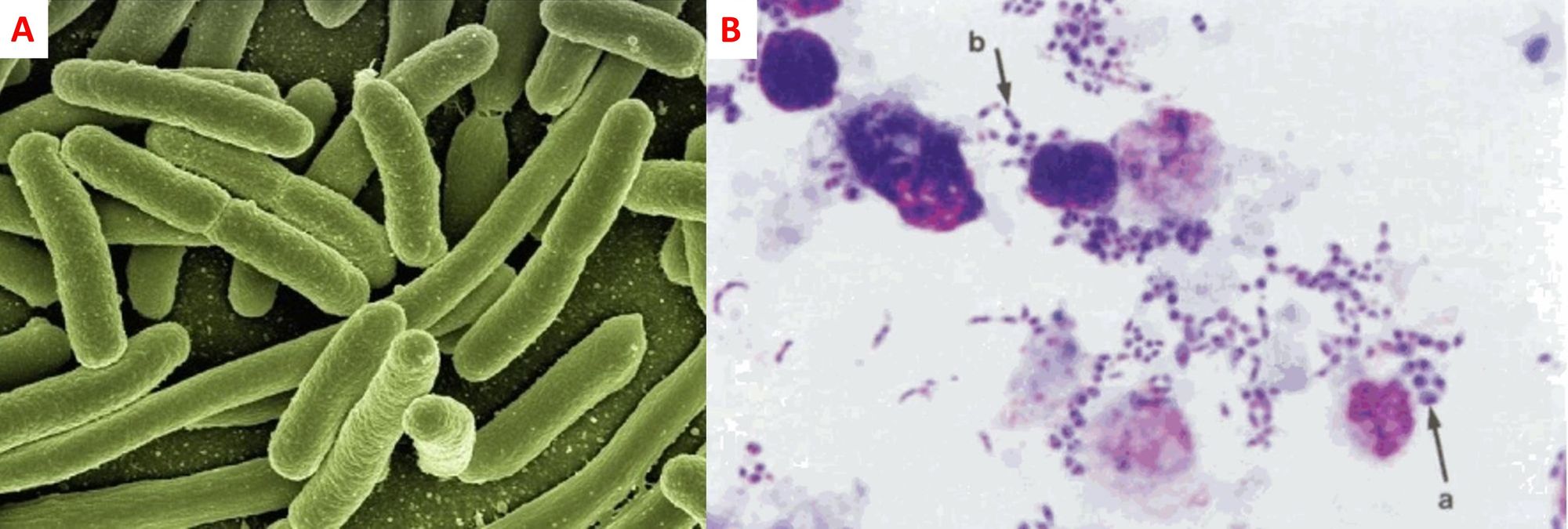 Infezioni sessualmente trasmissibili