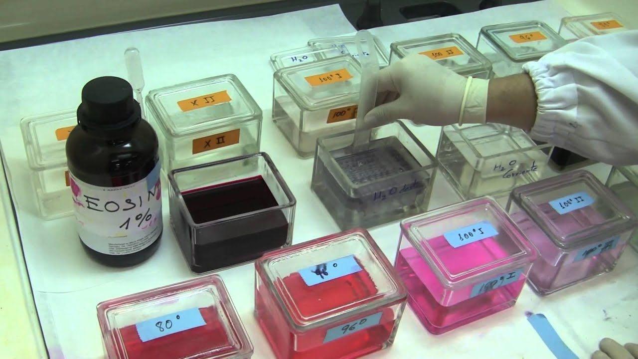 Colorazione istologica con ematossilina - eosina (EE): caratteristiche e procedimento
