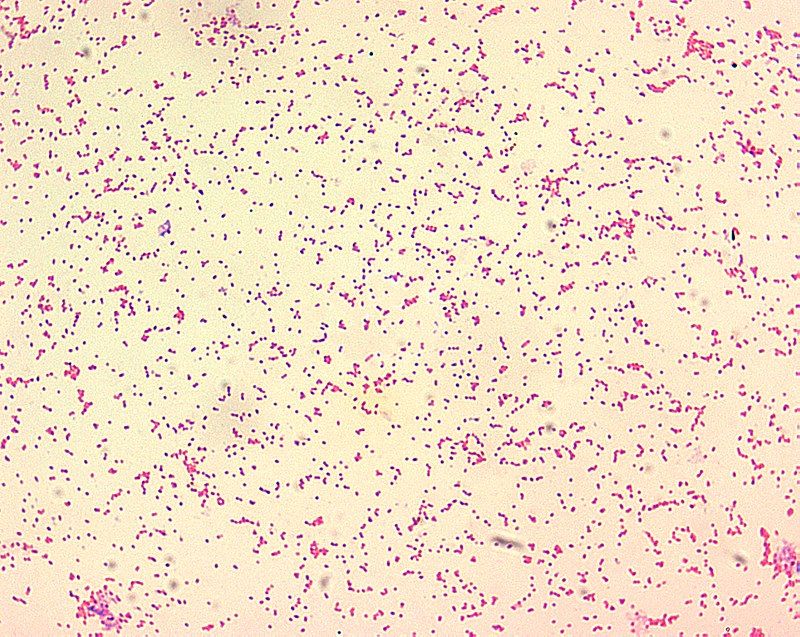 Brucella abortus: caratteristiche e patogenesi dell'attuale flagello che spaventa il Casertano