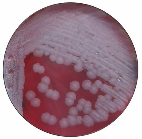 Antrace: da pericolosa tossina a preziosa risorsa farmacologica!