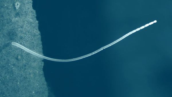 Un nuovo gigante: “Thiomargarita magnifica"