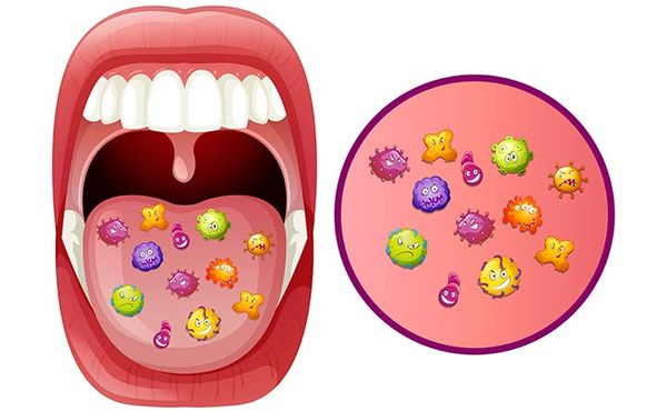 Batteri della bocca: amici o nemici?