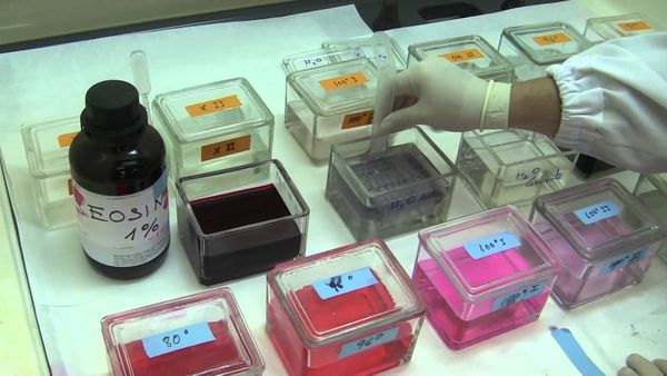 Colorazione istologica con ematossilina - eosina (EE): caratteristiche e procedimento