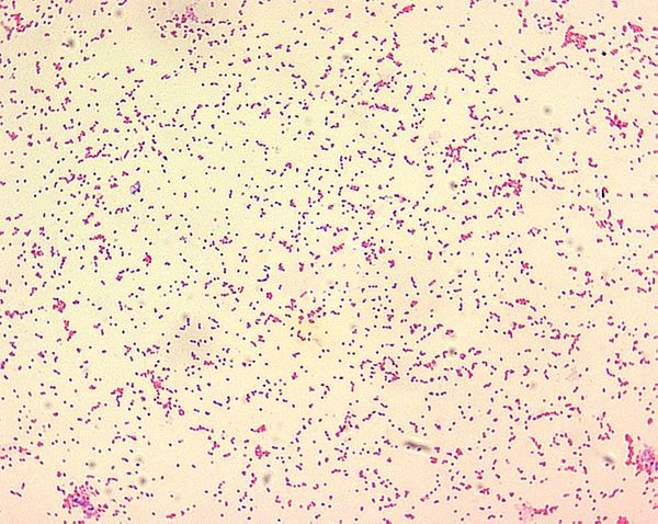 Brucella abortus: caratteristiche e patogenesi dell'attuale flagello che spaventa il Casertano