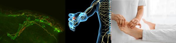 Immunofluorescenza e diagnostica neuropatica